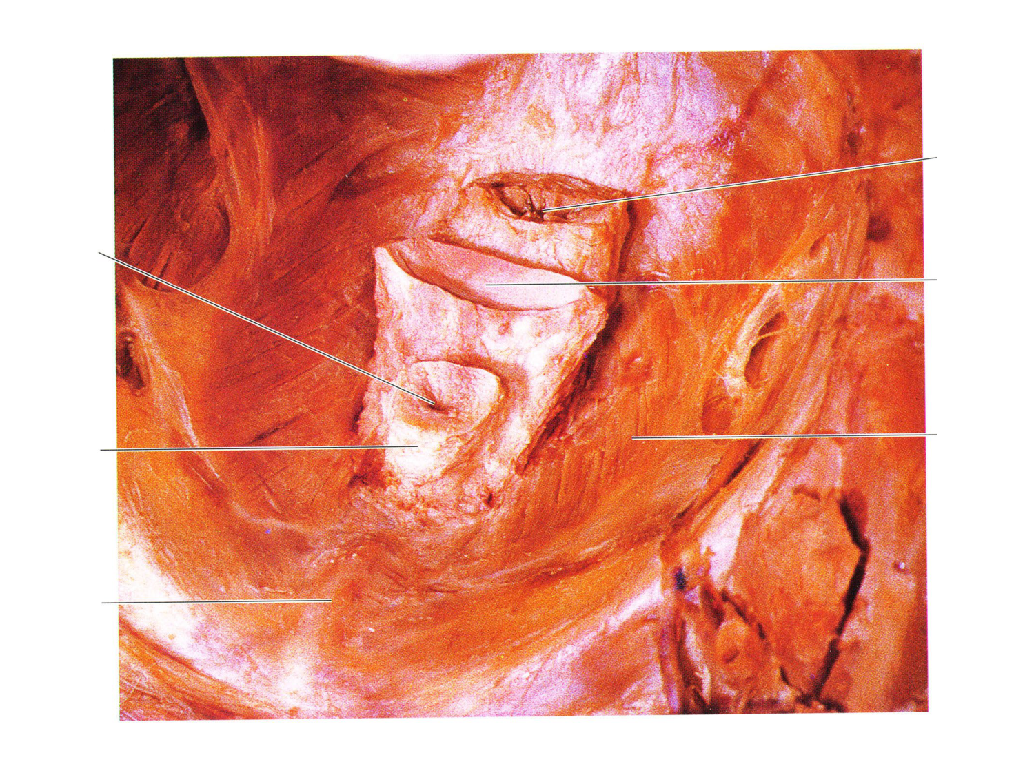 Splanchnologie generale; Pelvis-Perinée système reproducteur (homme et femme)1 page 63