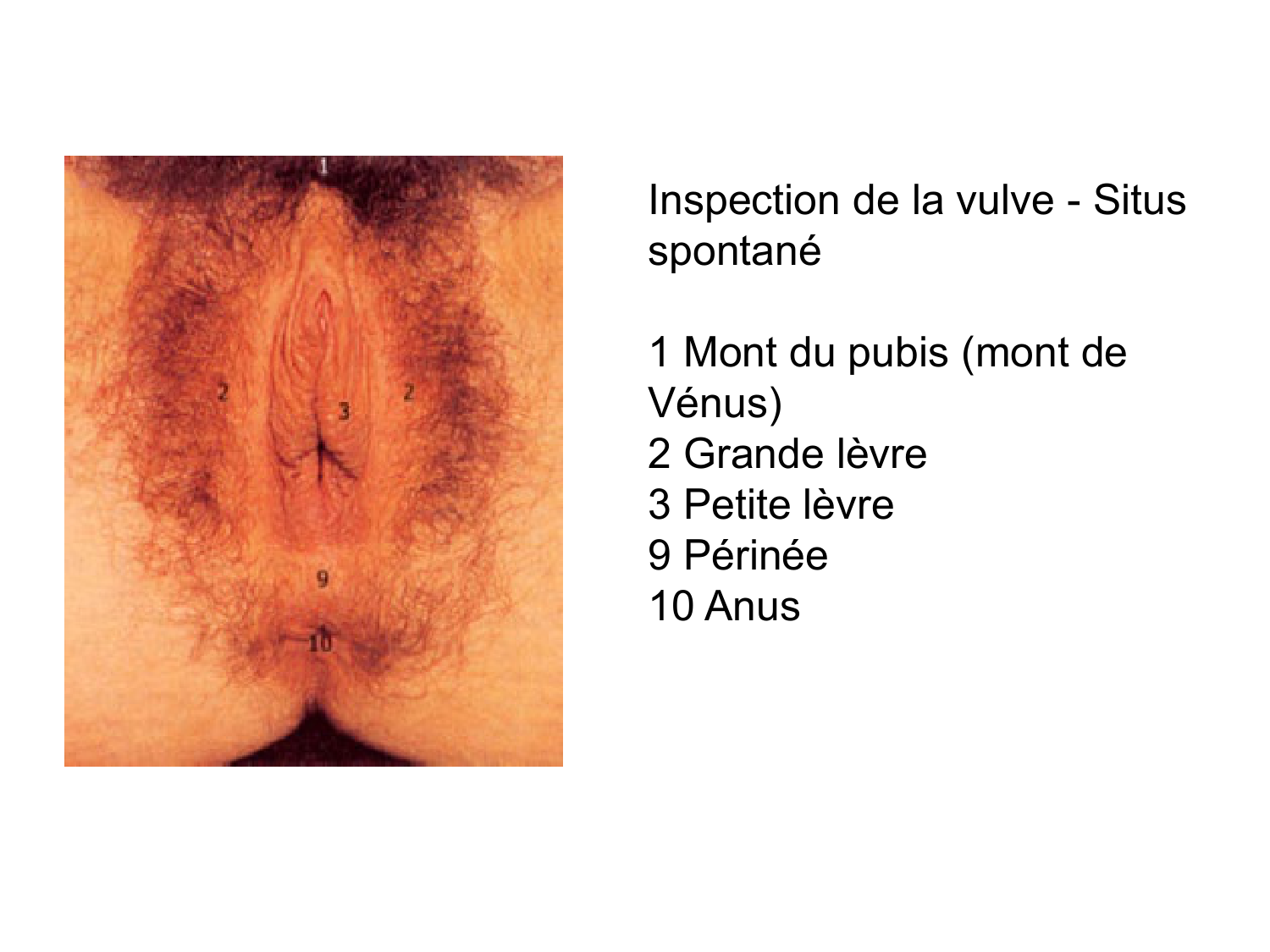 Splanchnologie generale; Pelvis-Perinée système reproducteur (homme et femme)1 page 73