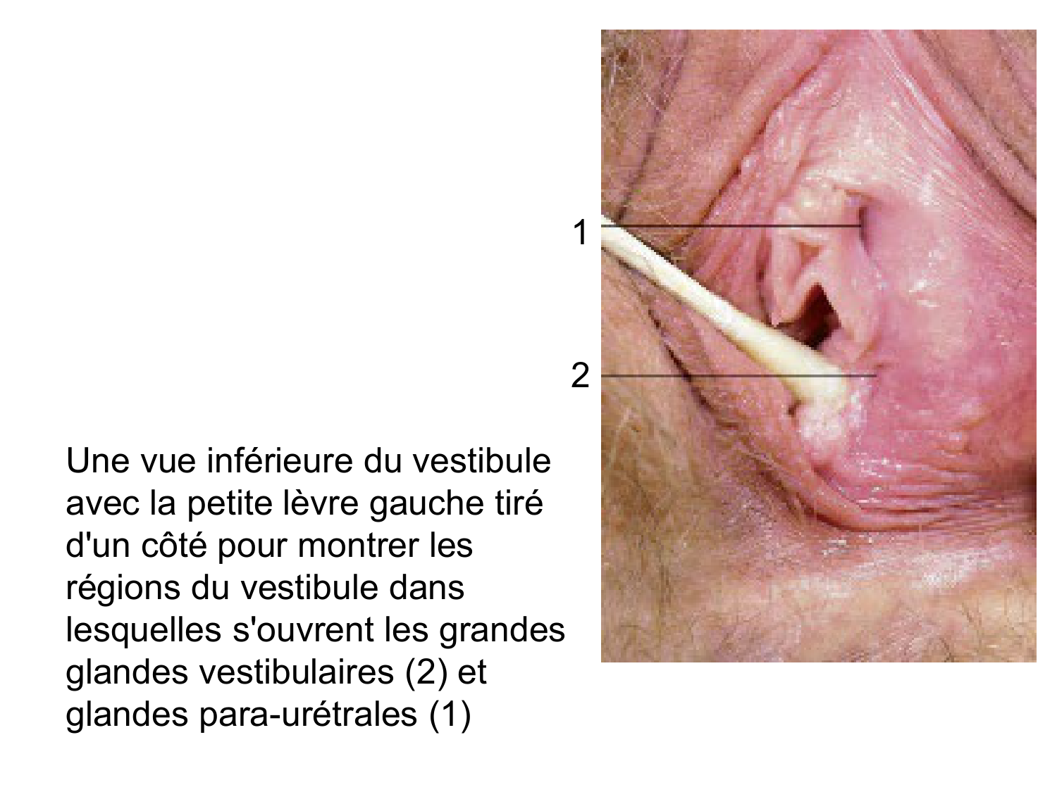Splanchnologie generale; Pelvis-Perinée système reproducteur (homme et femme)1 page 76