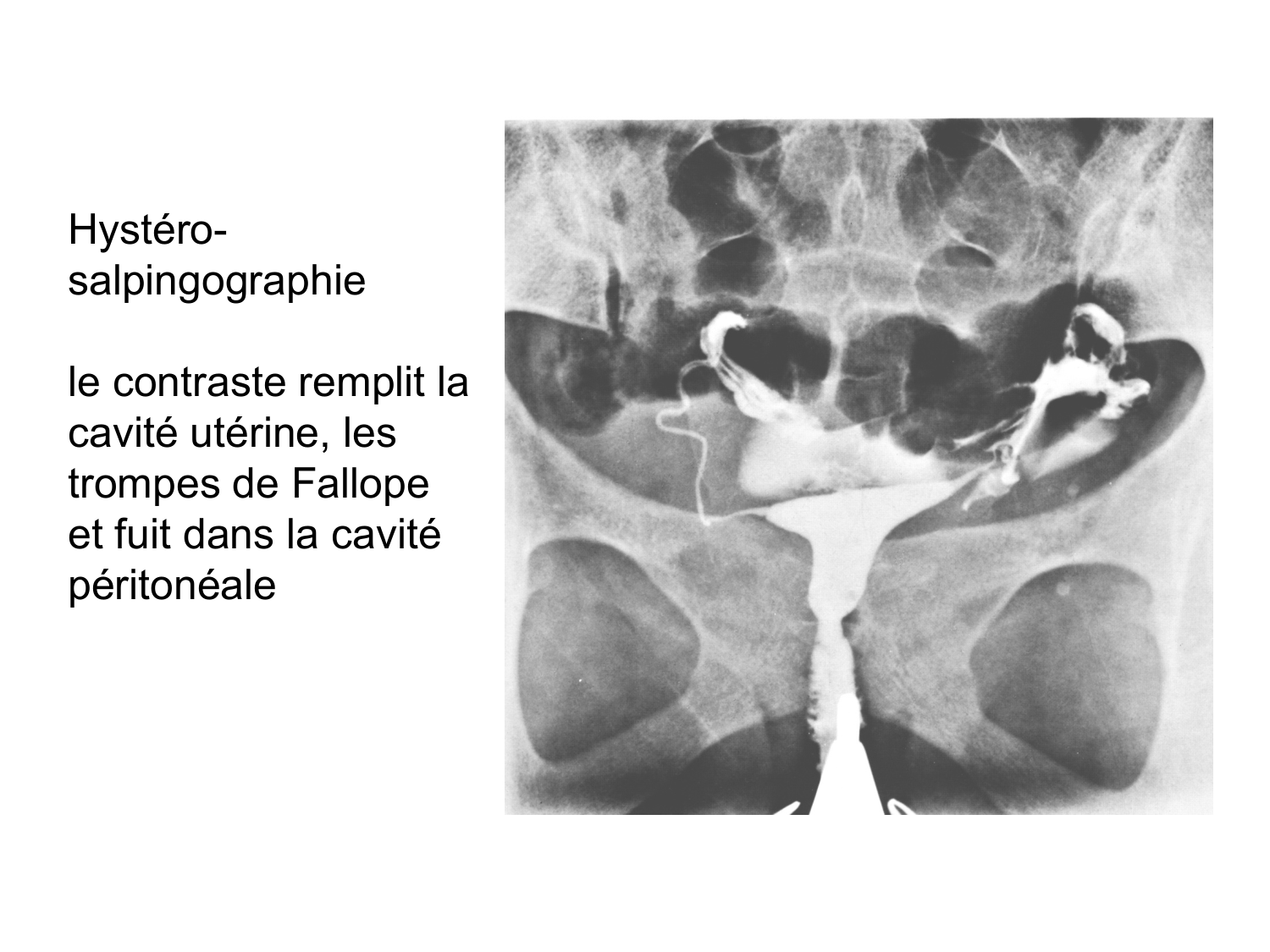 Splanchnologie generale; Pelvis-Perinée système reproducteur (homme et femme)1 page 98