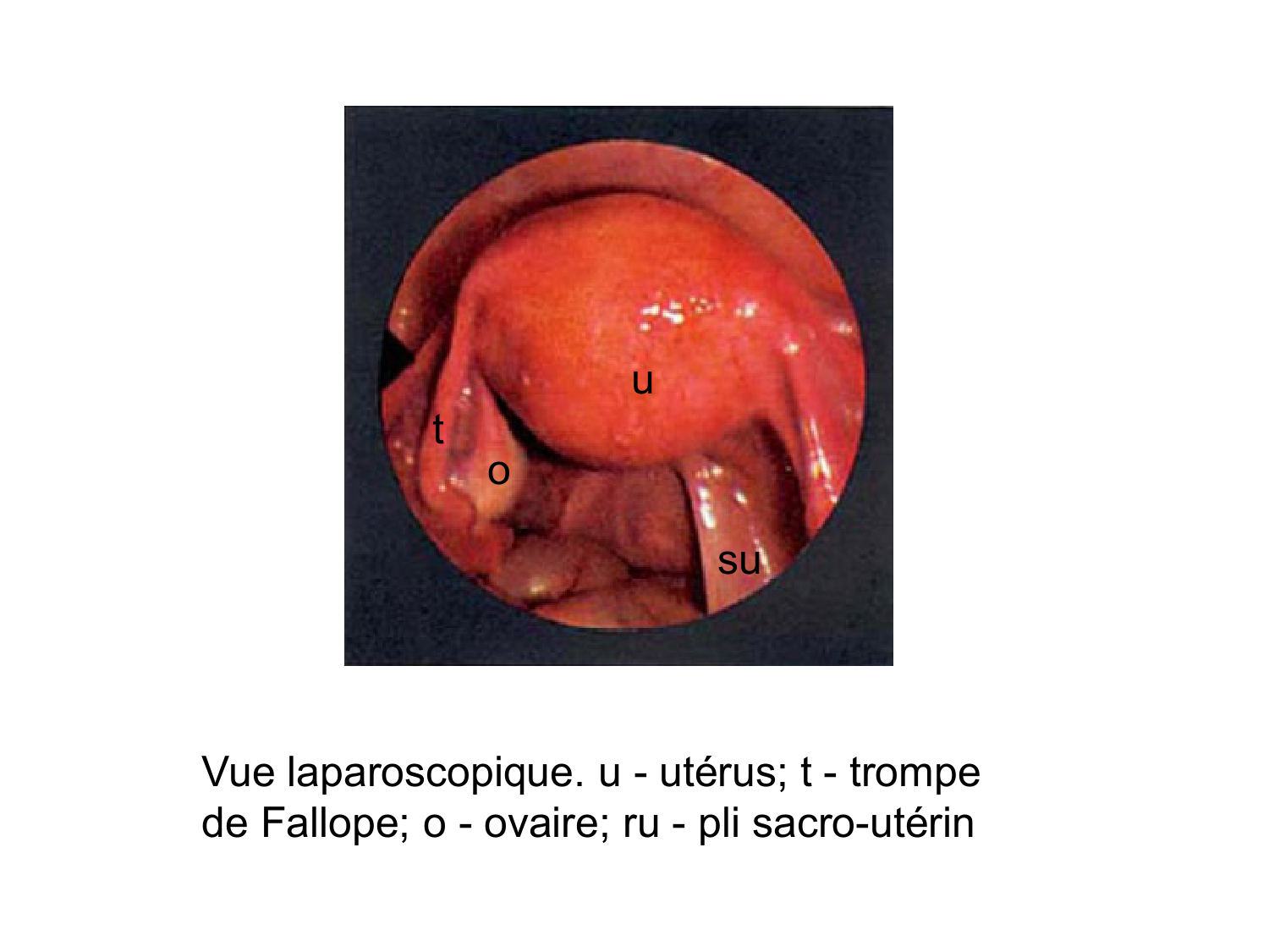 Splanchnologie generale; Pelvis-Perinée système reproducteur (homme et femme)1 page 99