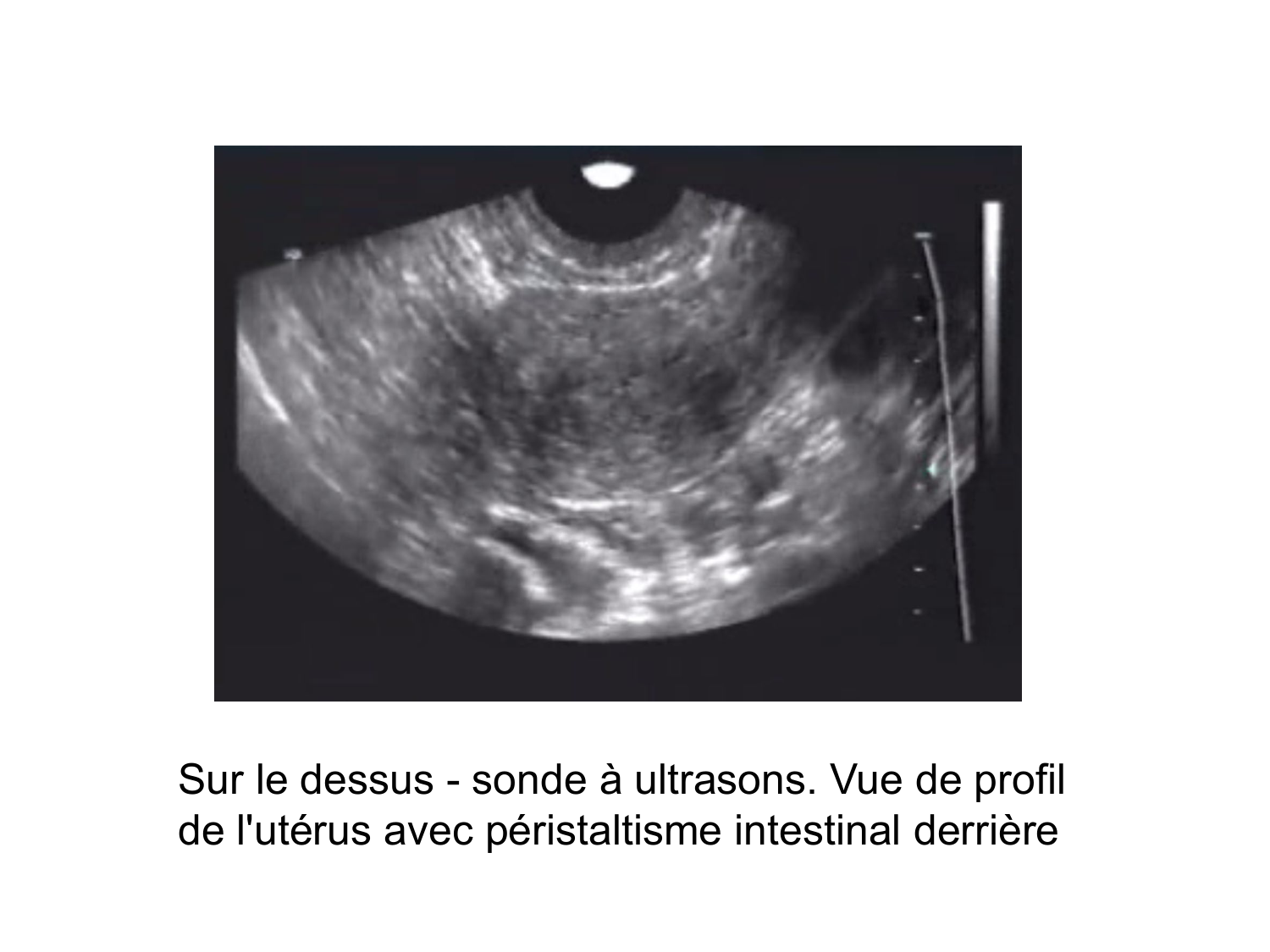 Splanchnologie generale; Pelvis-Perinée système reproducteur (homme et femme)1 page 100
