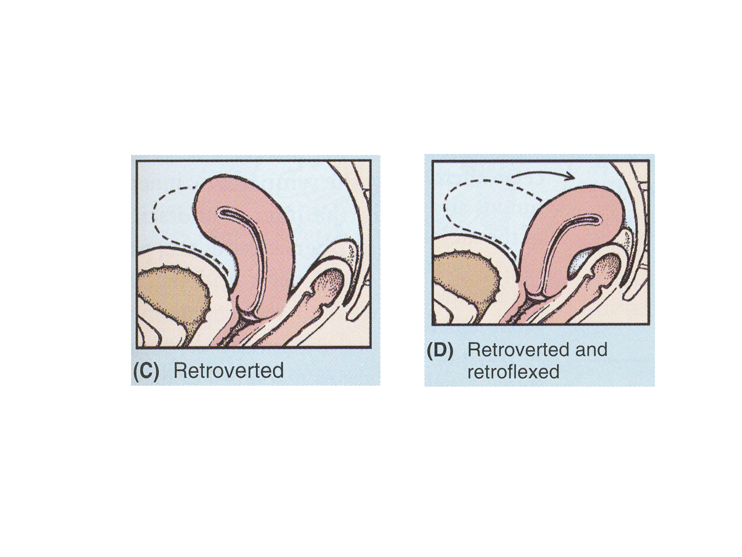 Splanchnologie generale; Pelvis-Perinée système reproducteur (homme et femme)1 page 106