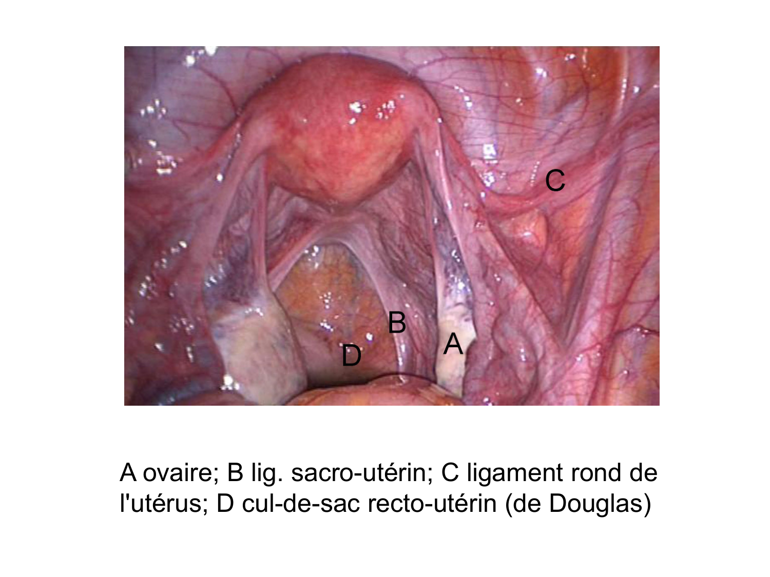 Splanchnologie generale; Pelvis-Perinée système reproducteur (homme et femme)1 page 120