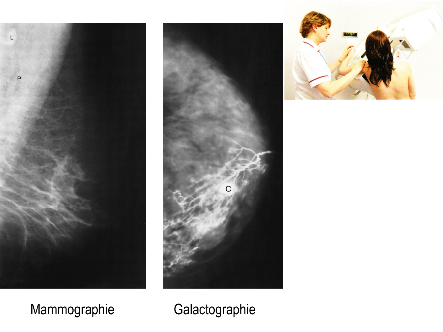 Splanchnologie generale; Pelvis-Perinée système reproducteur (homme et femme)1 page 130