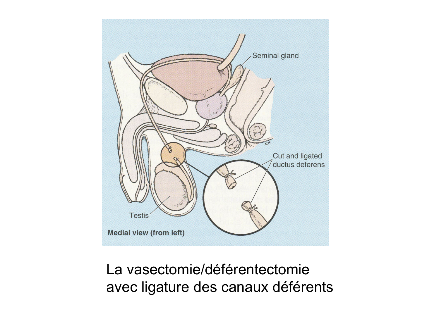 Splanchnologie generale; Pelvis-Perinée système reproducteur (homme et femme)1 page 156
