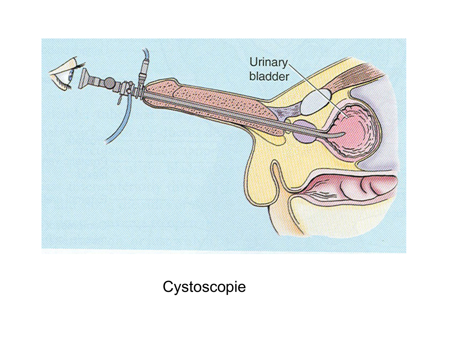 Splanchnologie generale; Pelvis-Perinée système reproducteur (homme et femme)1 page 171