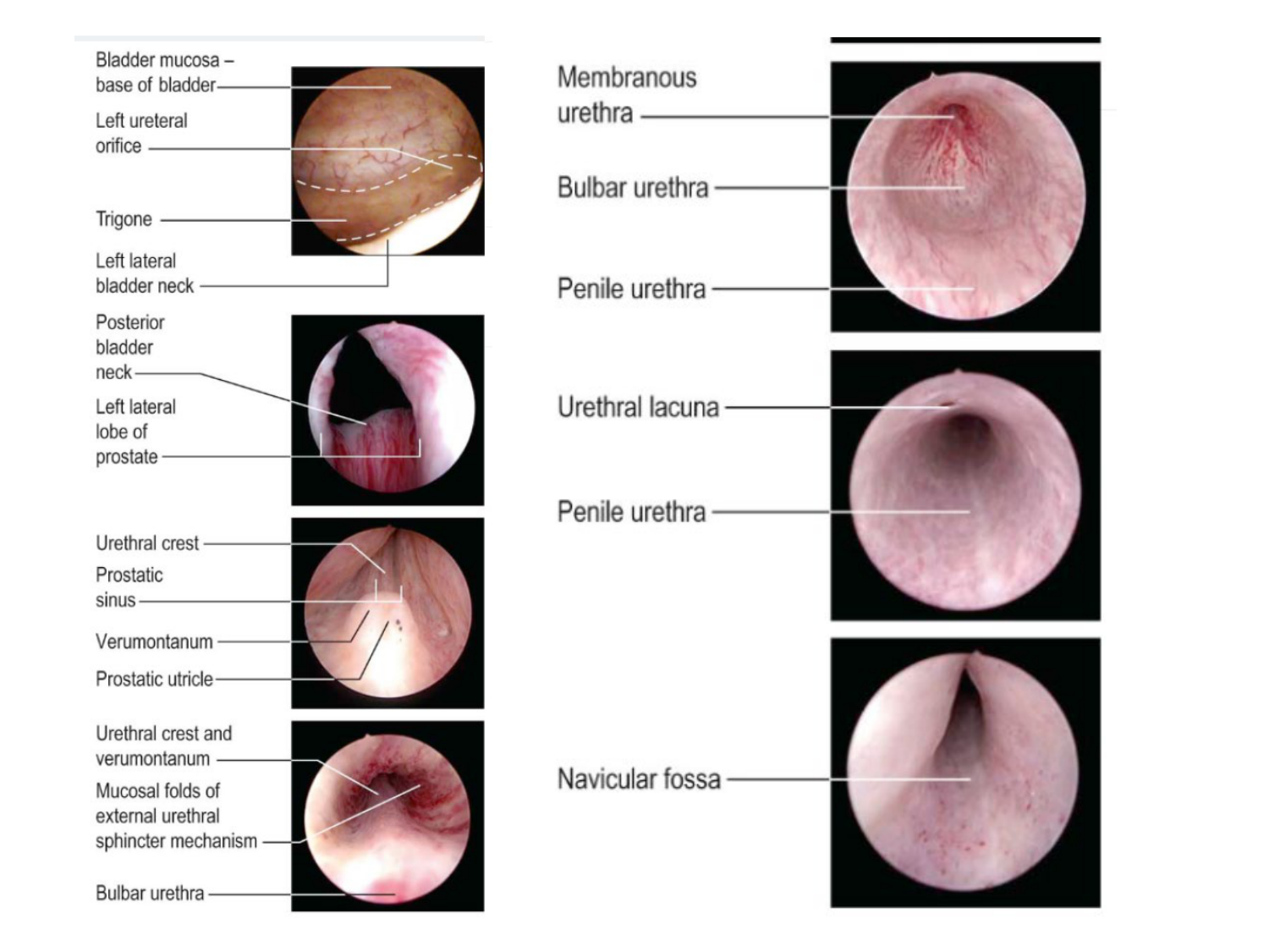 Splanchnologie generale; Pelvis-Perinée système reproducteur (homme et femme)1 page 173