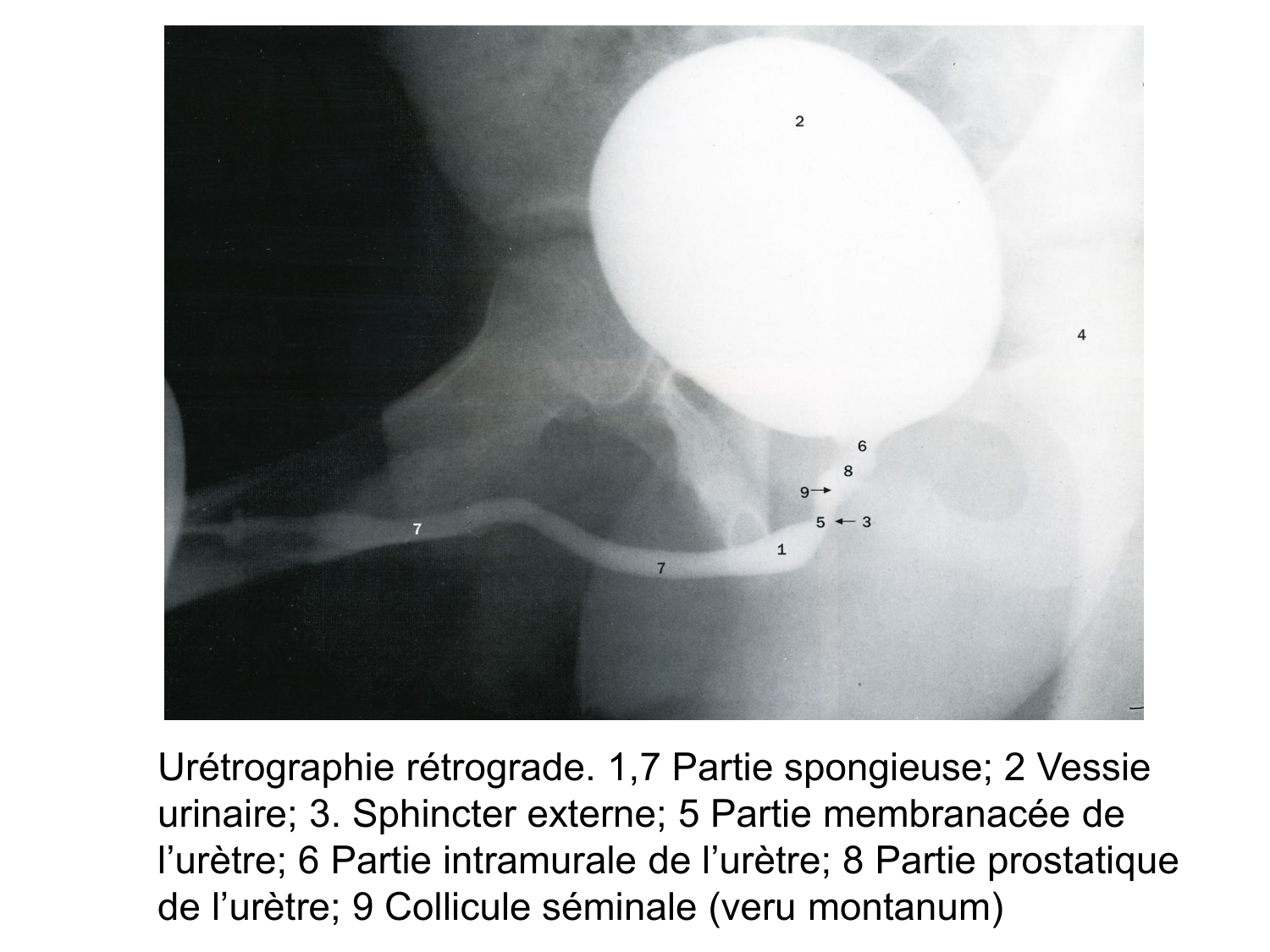 Splanchnologie generale; Pelvis-Perinée système reproducteur (homme et femme)1 page 174