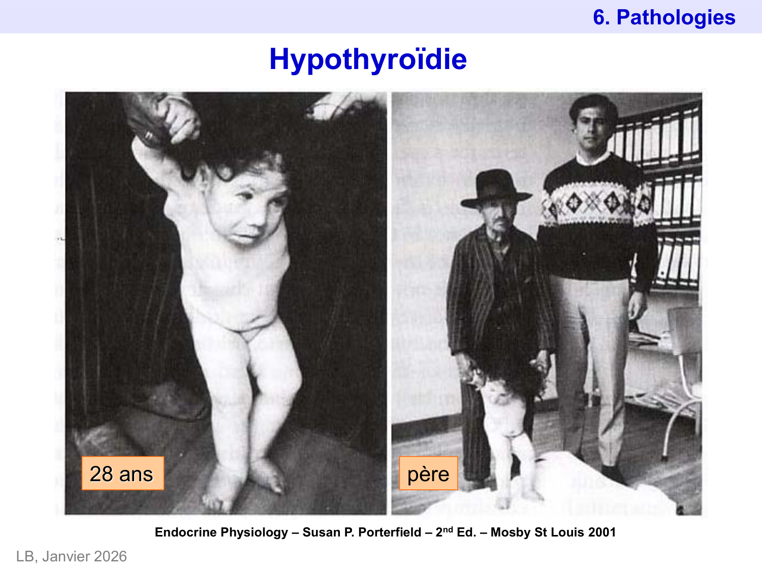 Hormones thyroïdiennes page 44