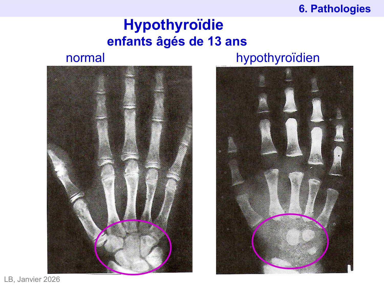 Hormones thyroïdiennes page 45