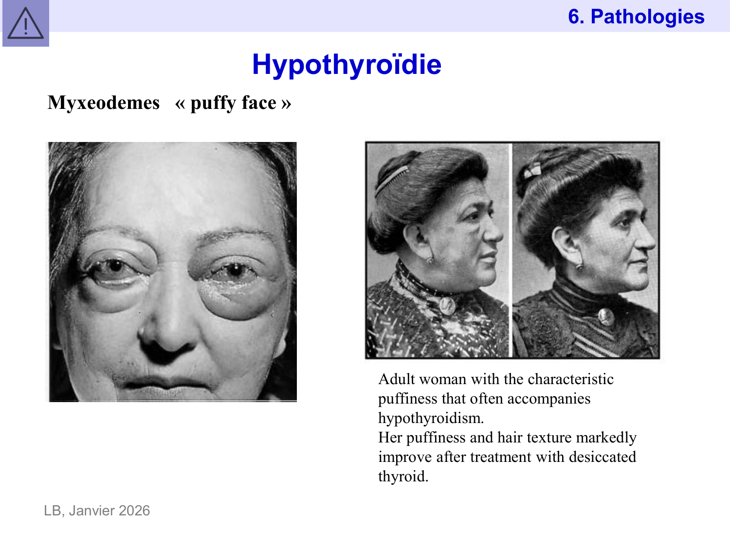 Hormones thyroïdiennes page 47