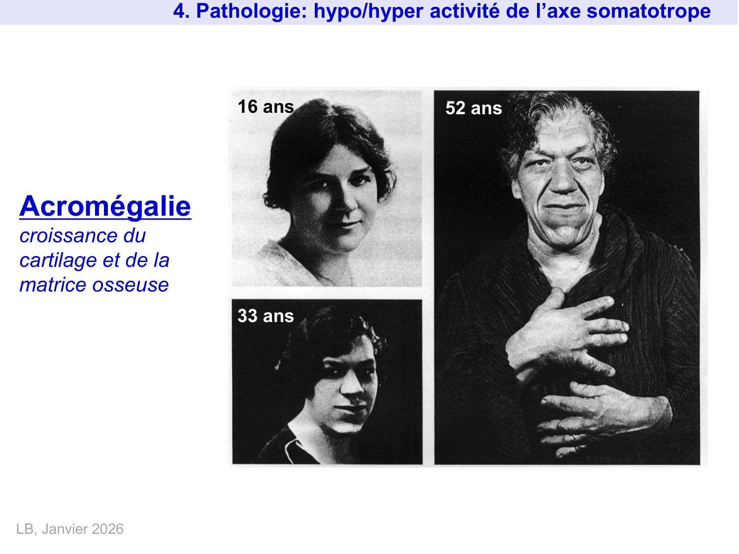 Hormone de croissance et prolactine page 34