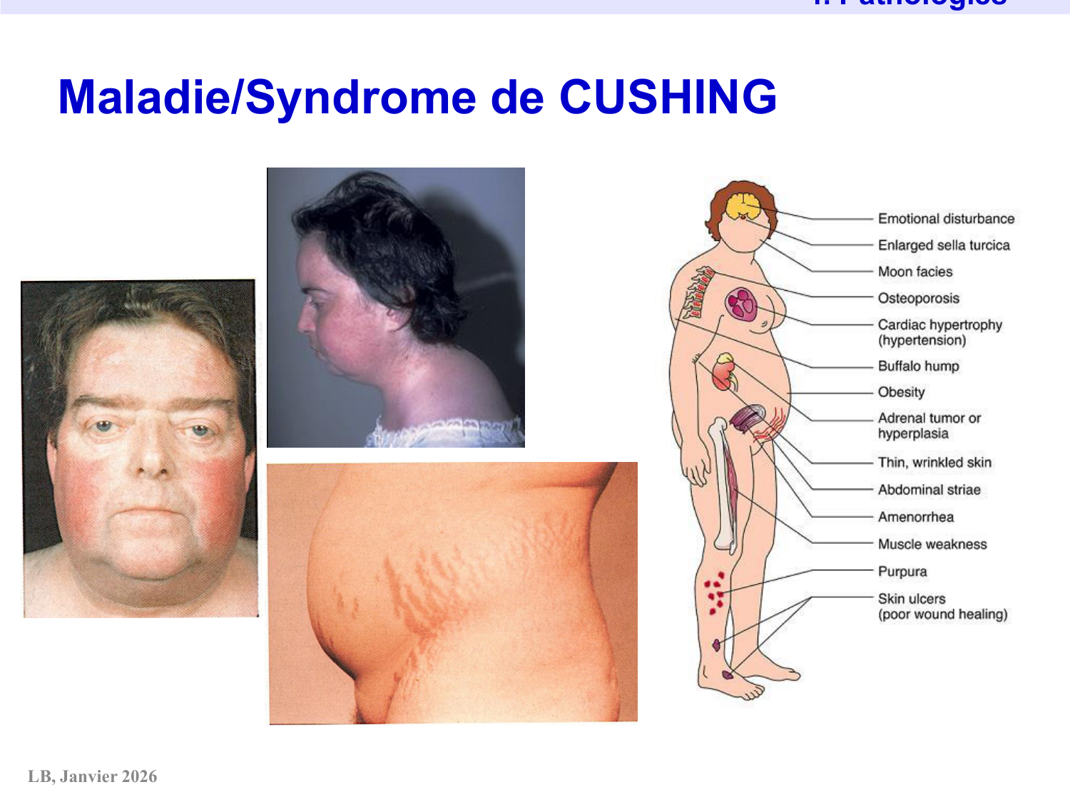 Axe CRH-ACTH-cortisol page 34