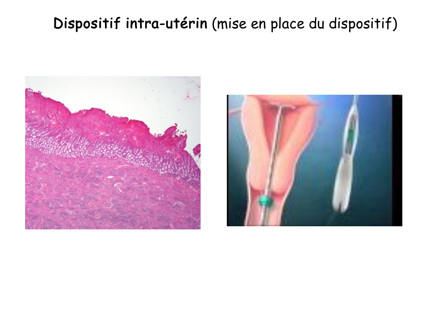 Reproduction — synthèse page 23