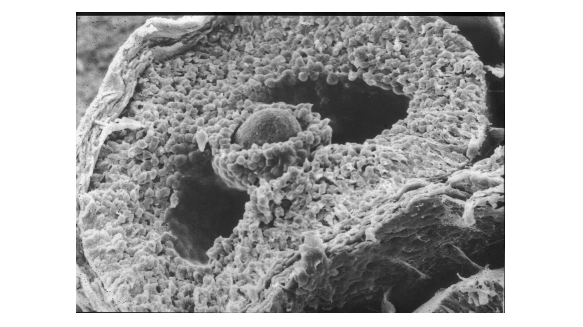 Gamétogenèse page 52