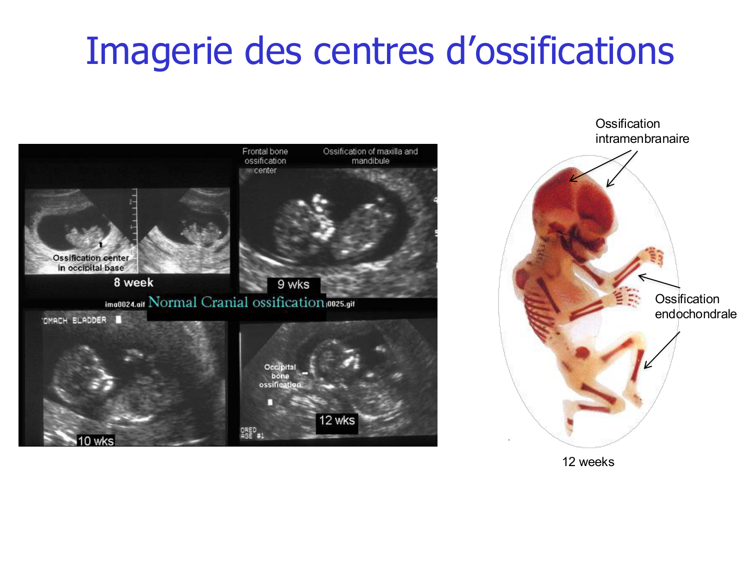 Croissance et os page 13