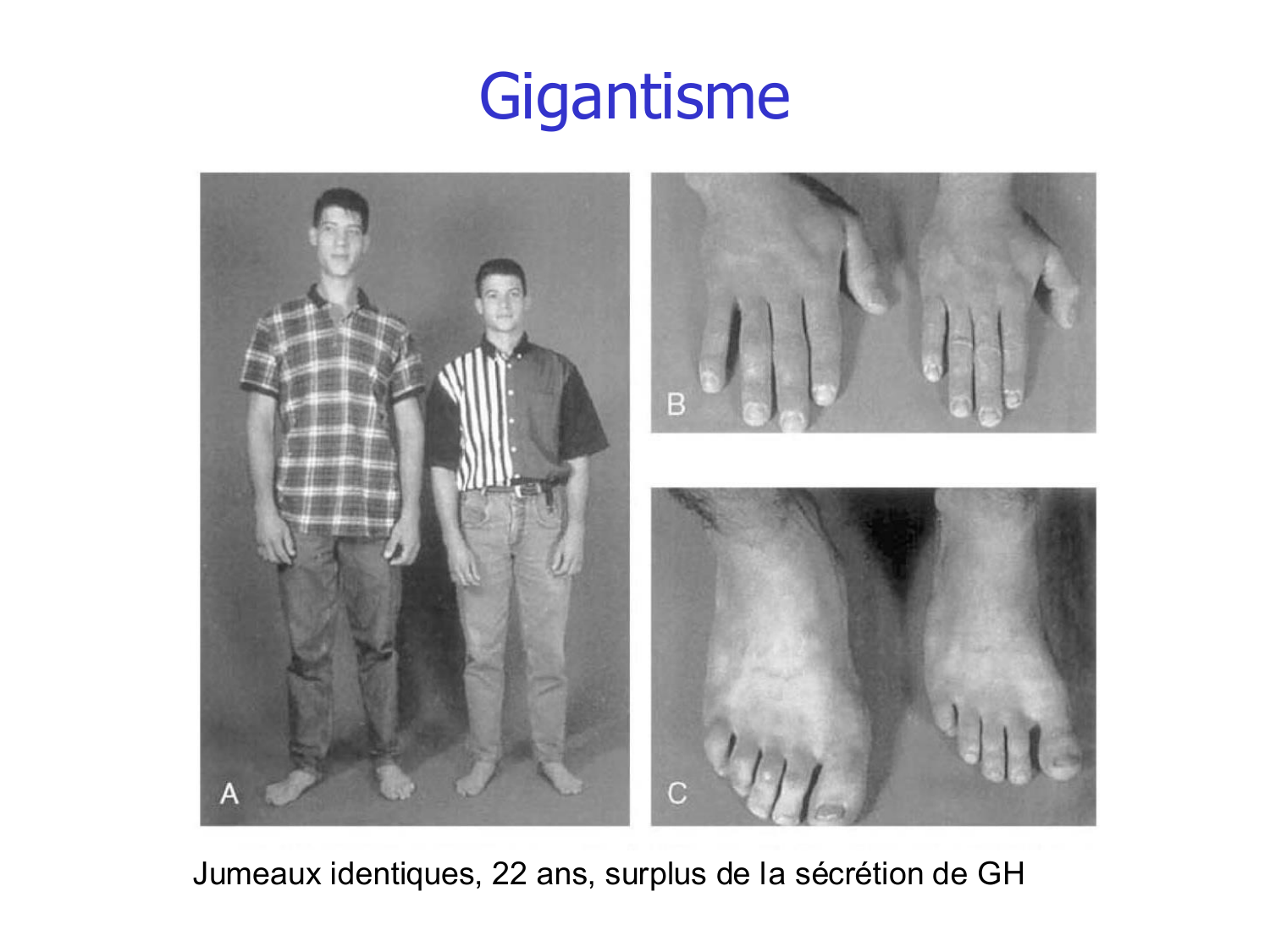 Croissance et os page 33