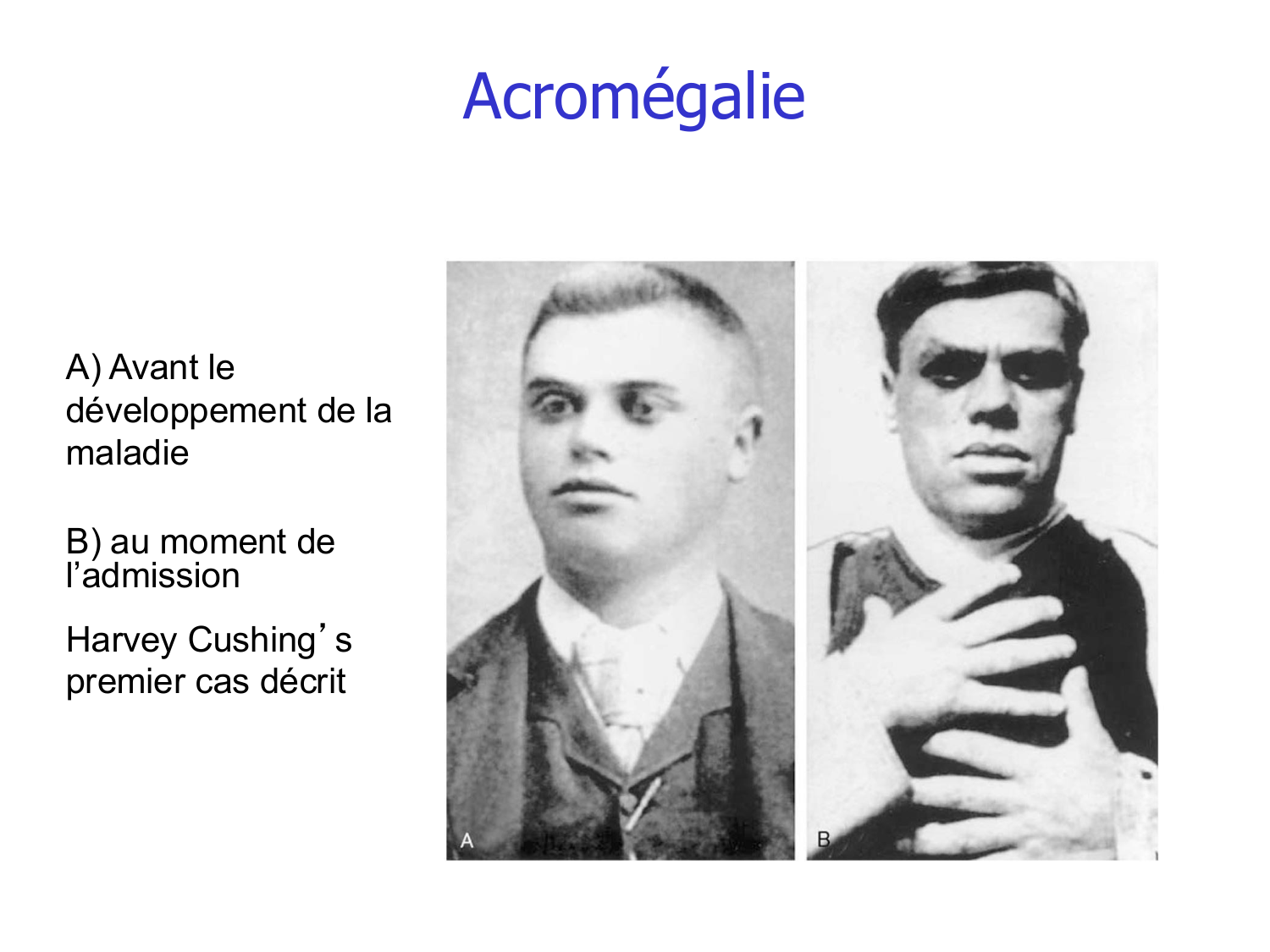 Croissance et os page 34