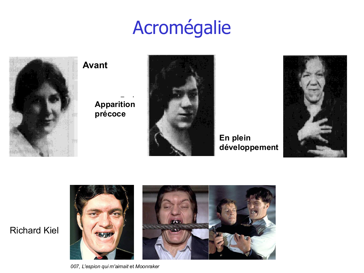 Croissance et os page 35