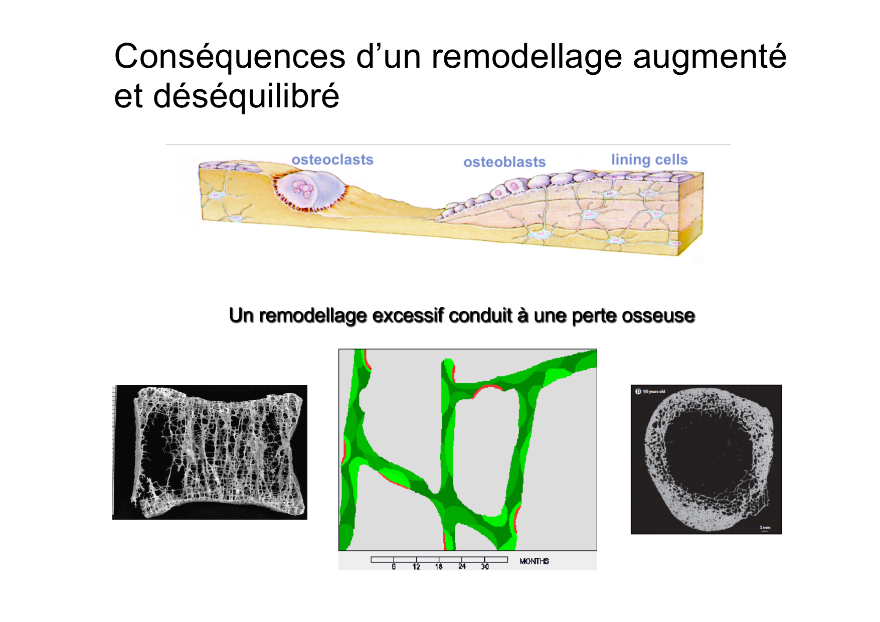 Remodelage osseux page 9
