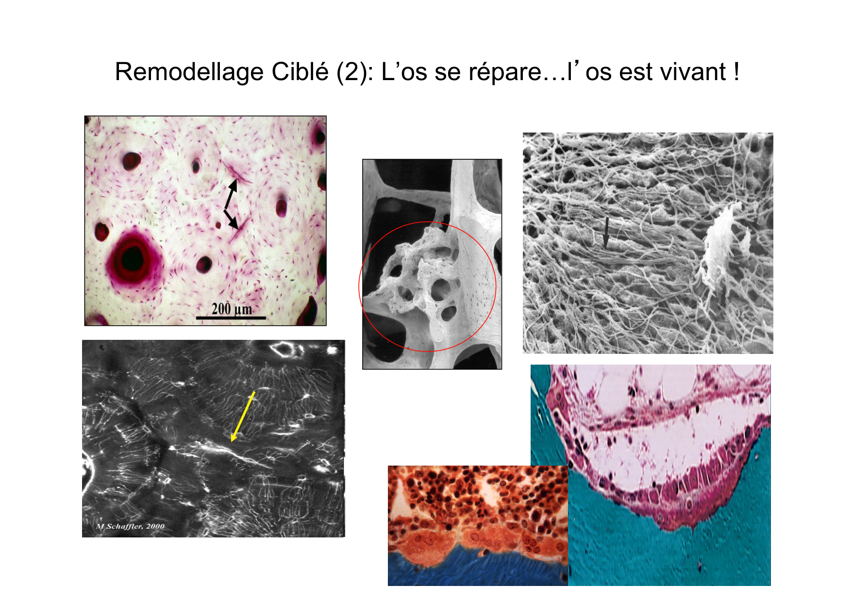 Remodelage osseux page 10