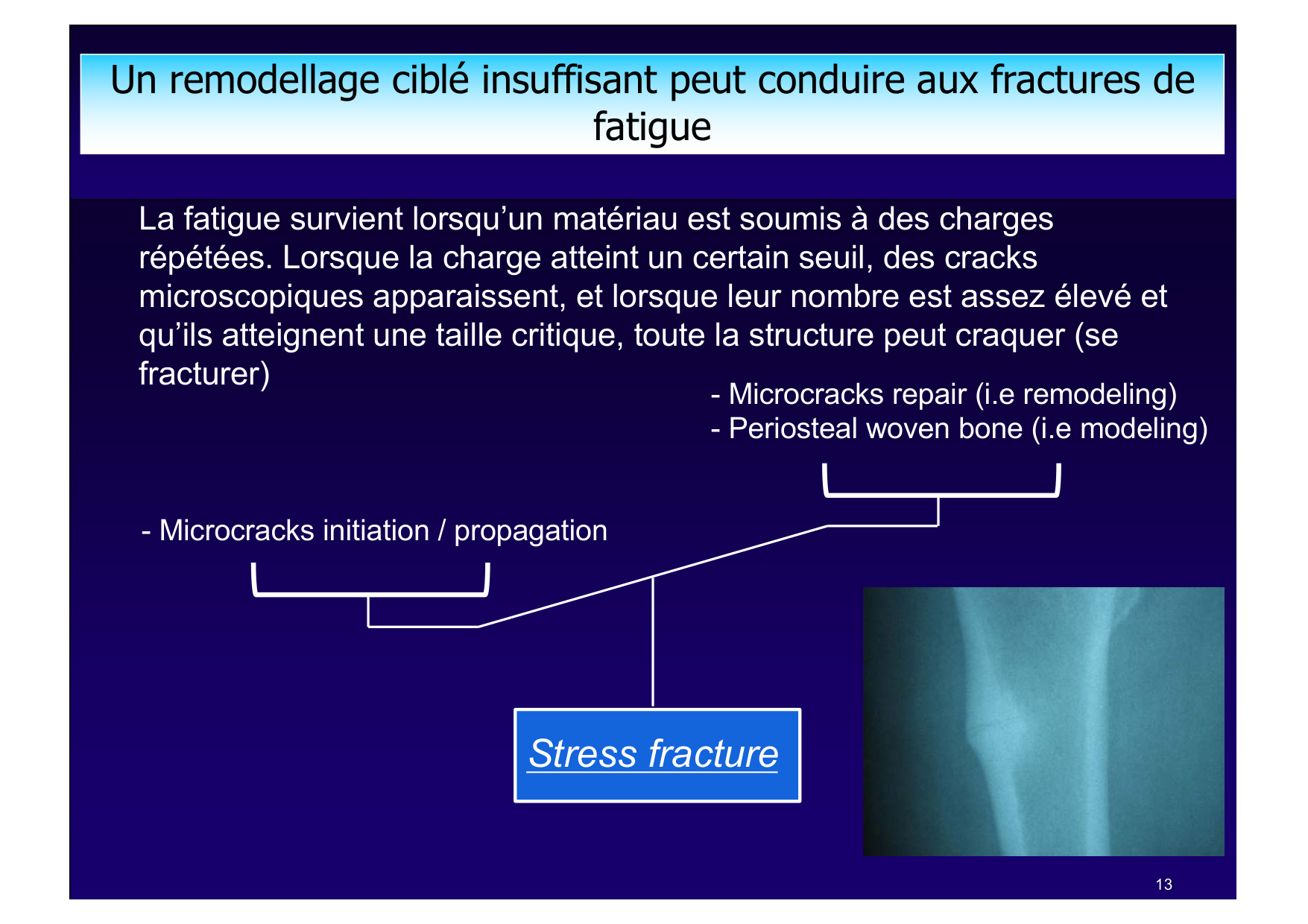 Remodelage osseux page 13