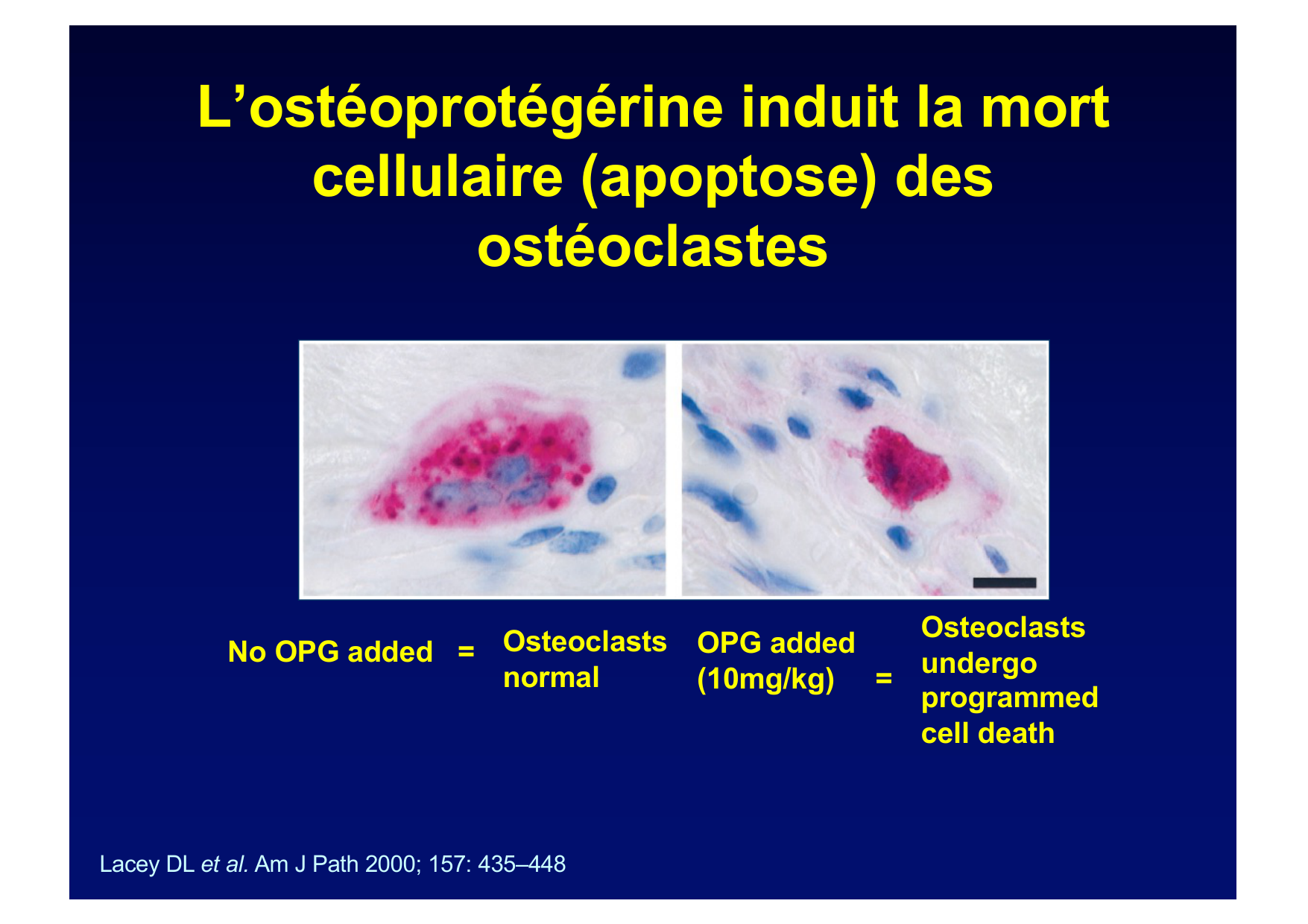 Remodelage osseux page 22