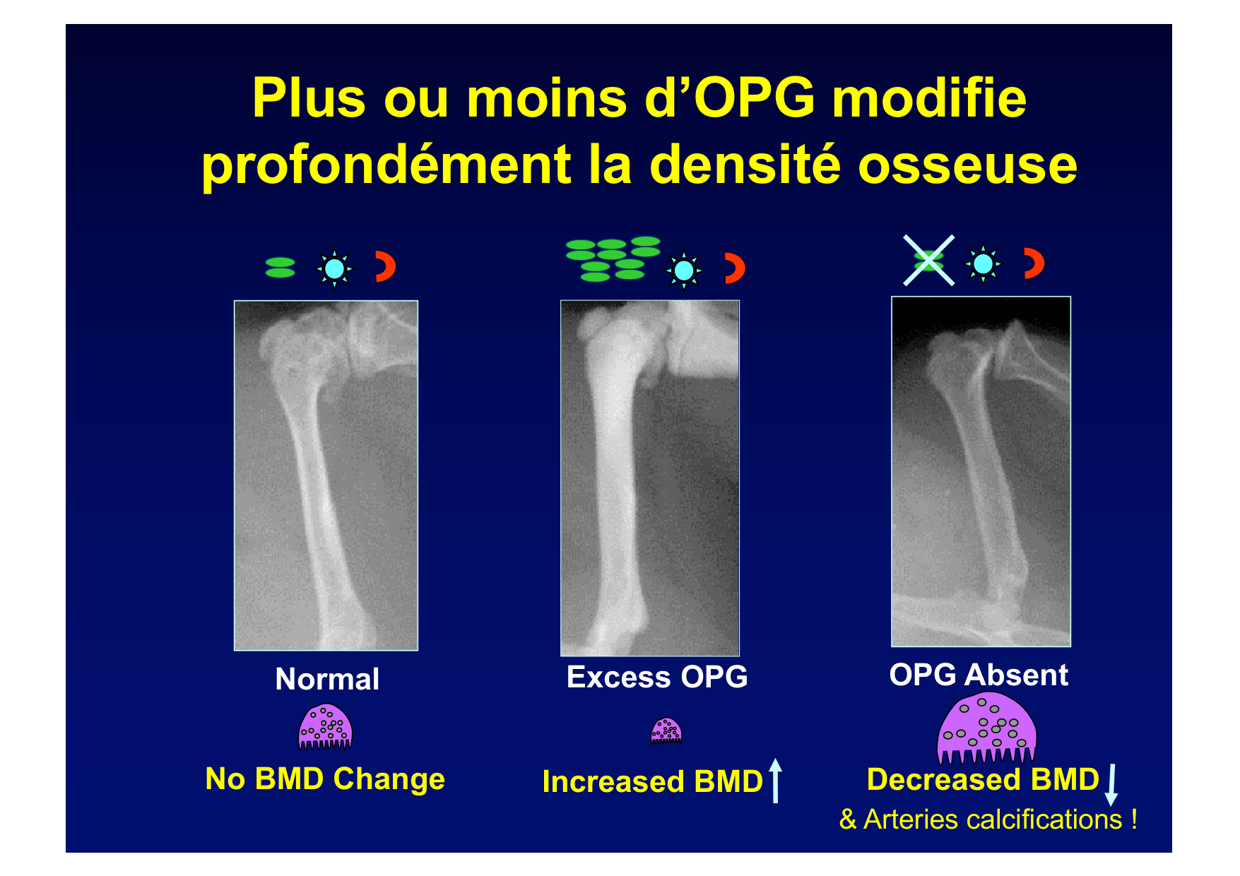 Remodelage osseux page 23