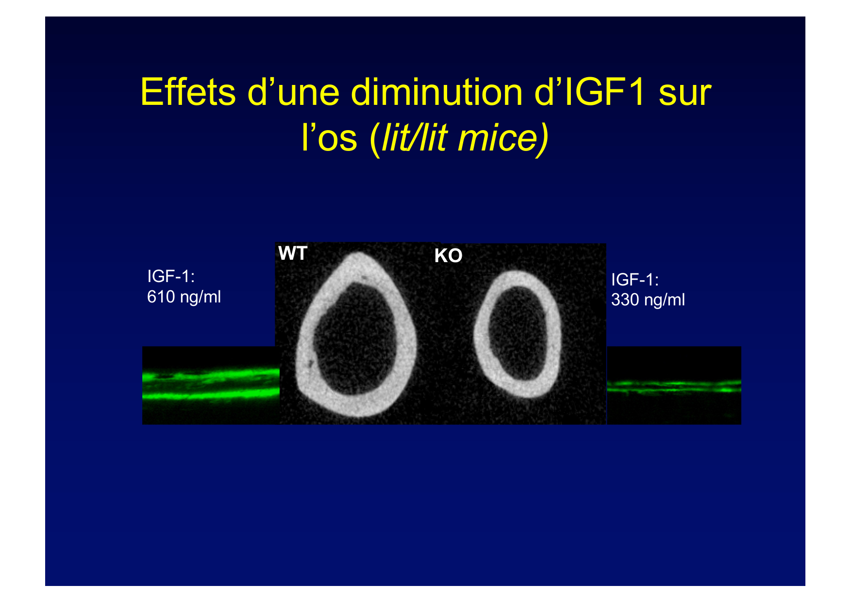 Remodelage osseux page 27