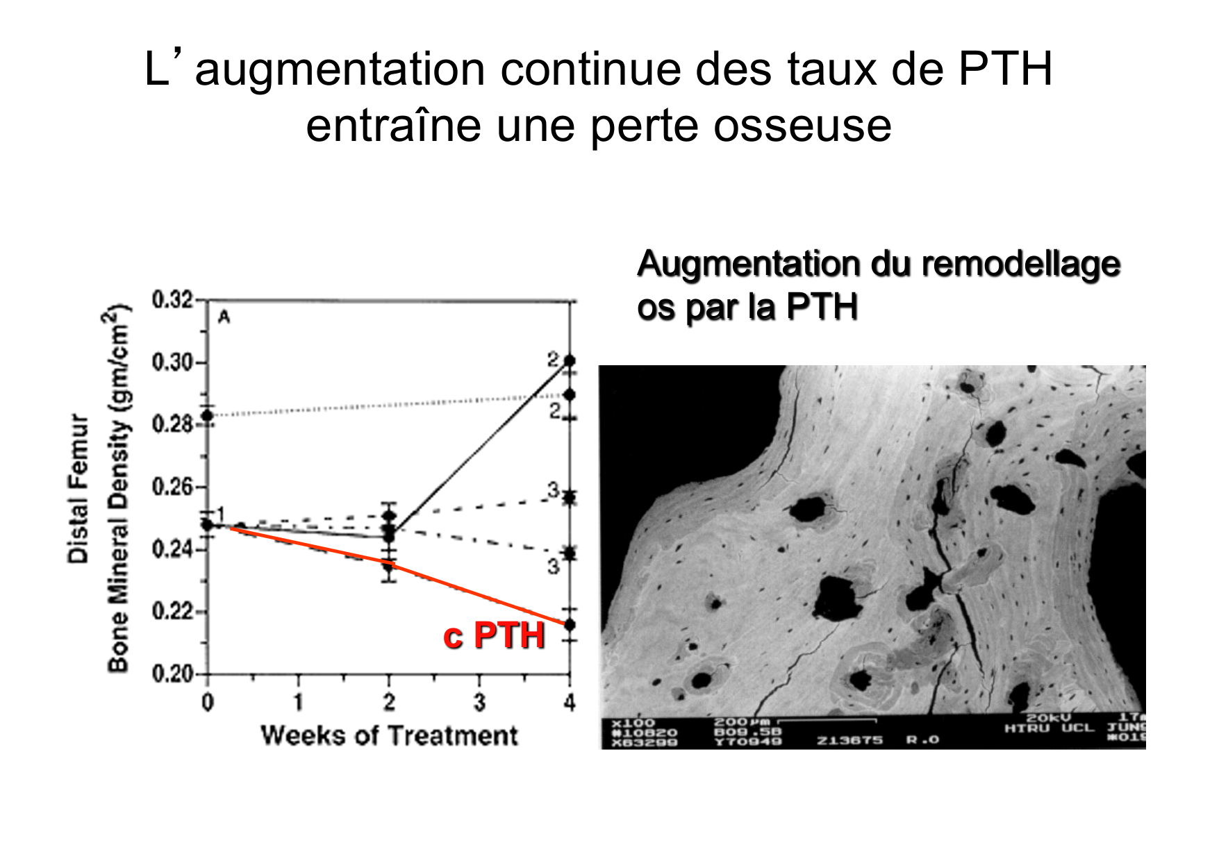 Remodelage osseux page 45