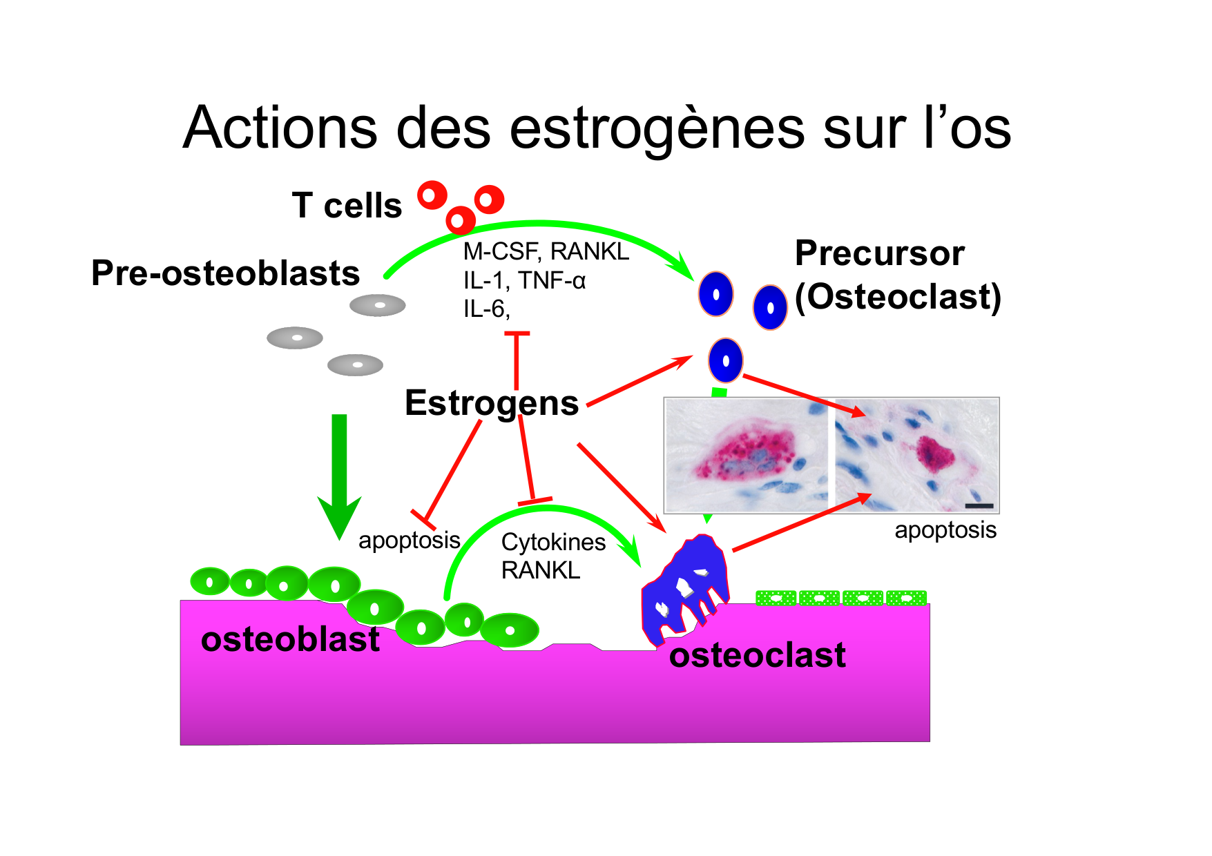 Remodelage osseux page 46