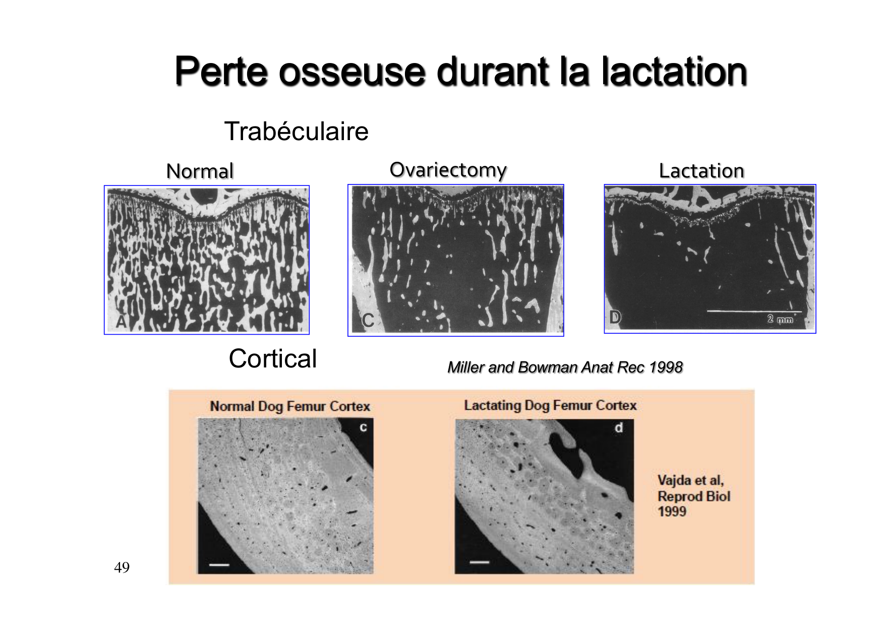 Remodelage osseux page 49
