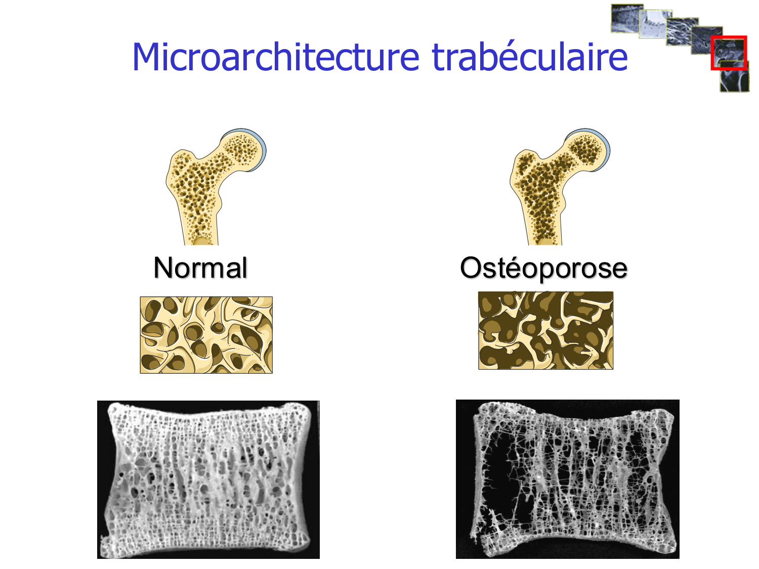 Structure et minéralisation osseuses page 20