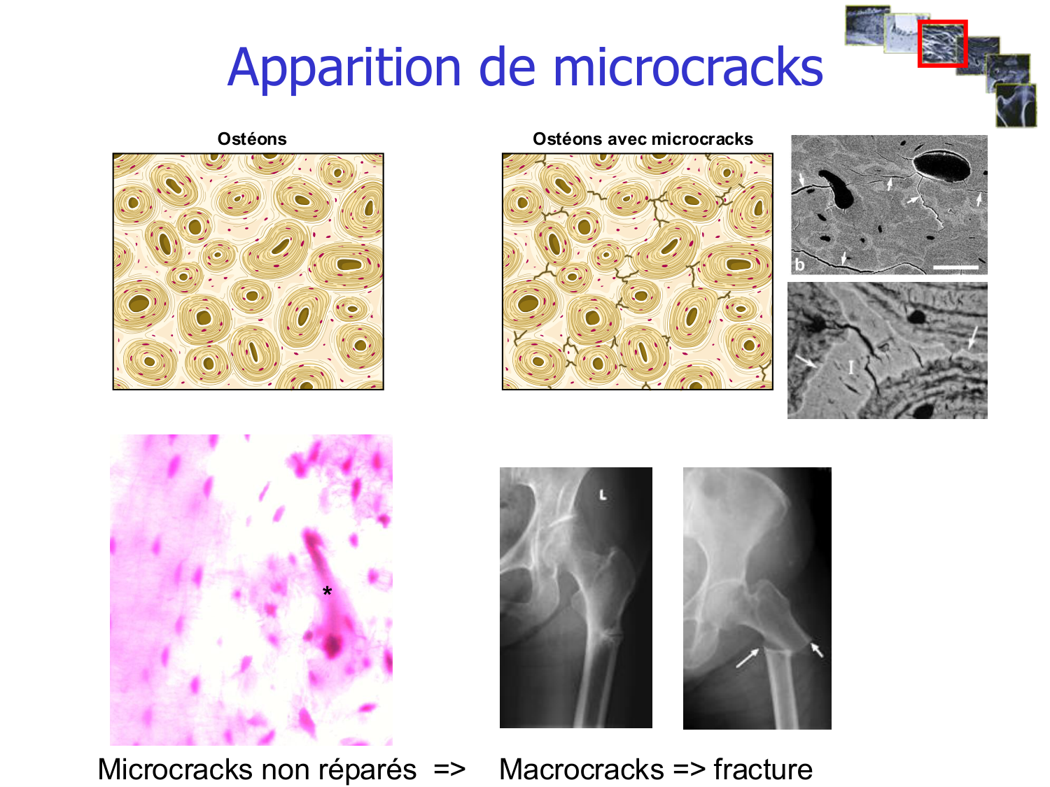 Structure et minéralisation osseuses page 30