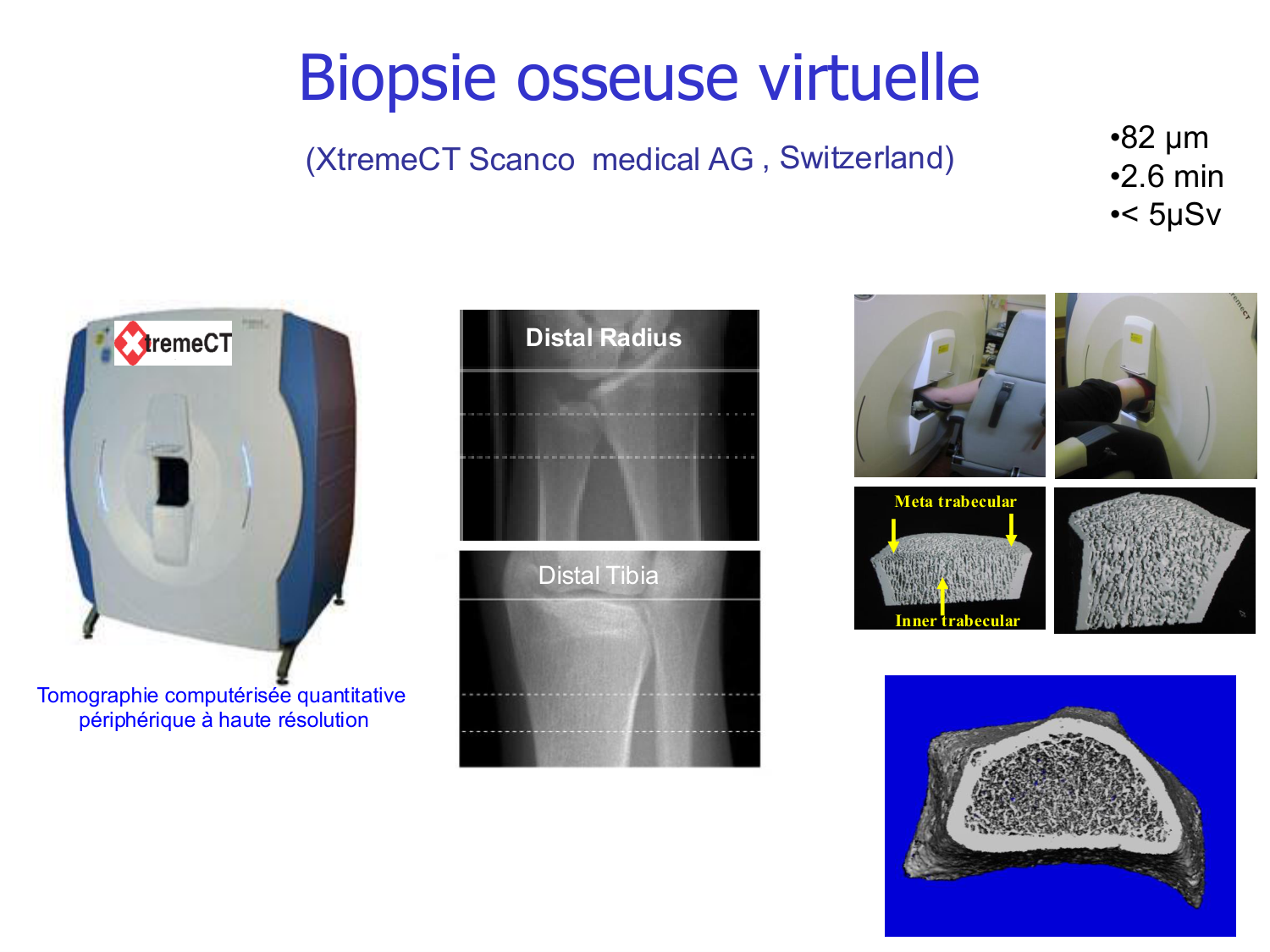 Structure et minéralisation osseuses page 44