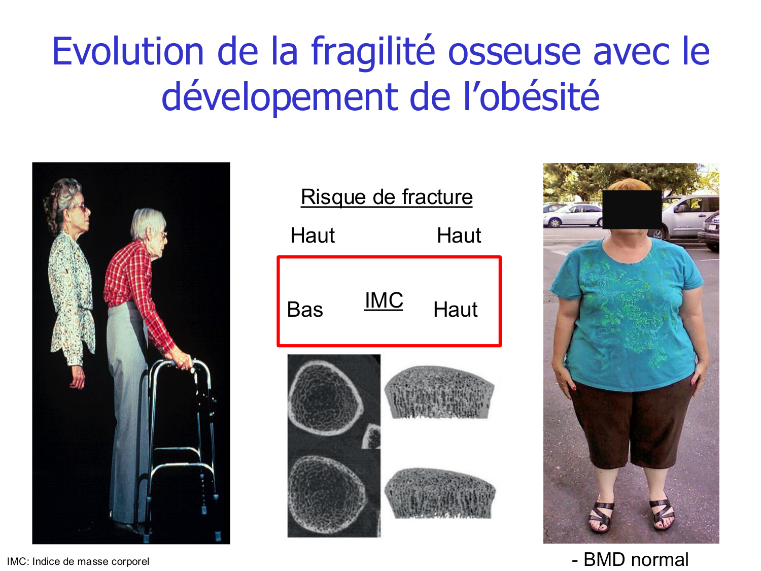 Structure et minéralisation osseuses page 46