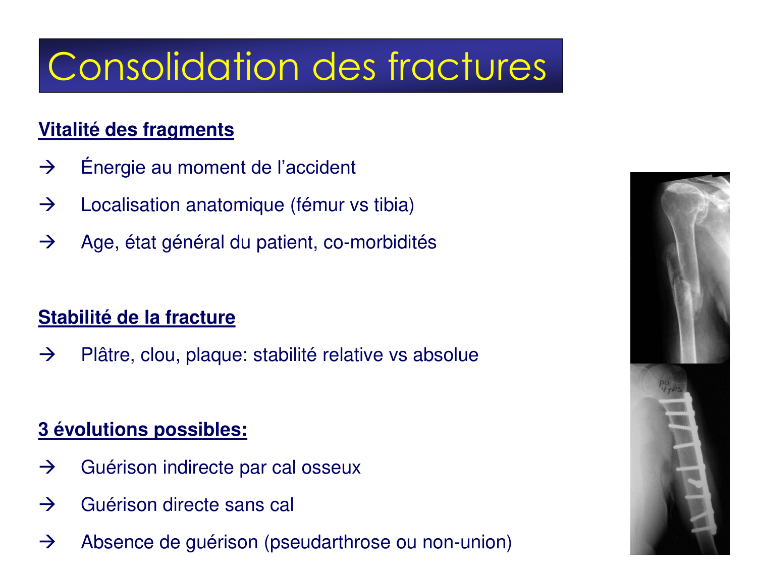 Fractures et réparation page 7