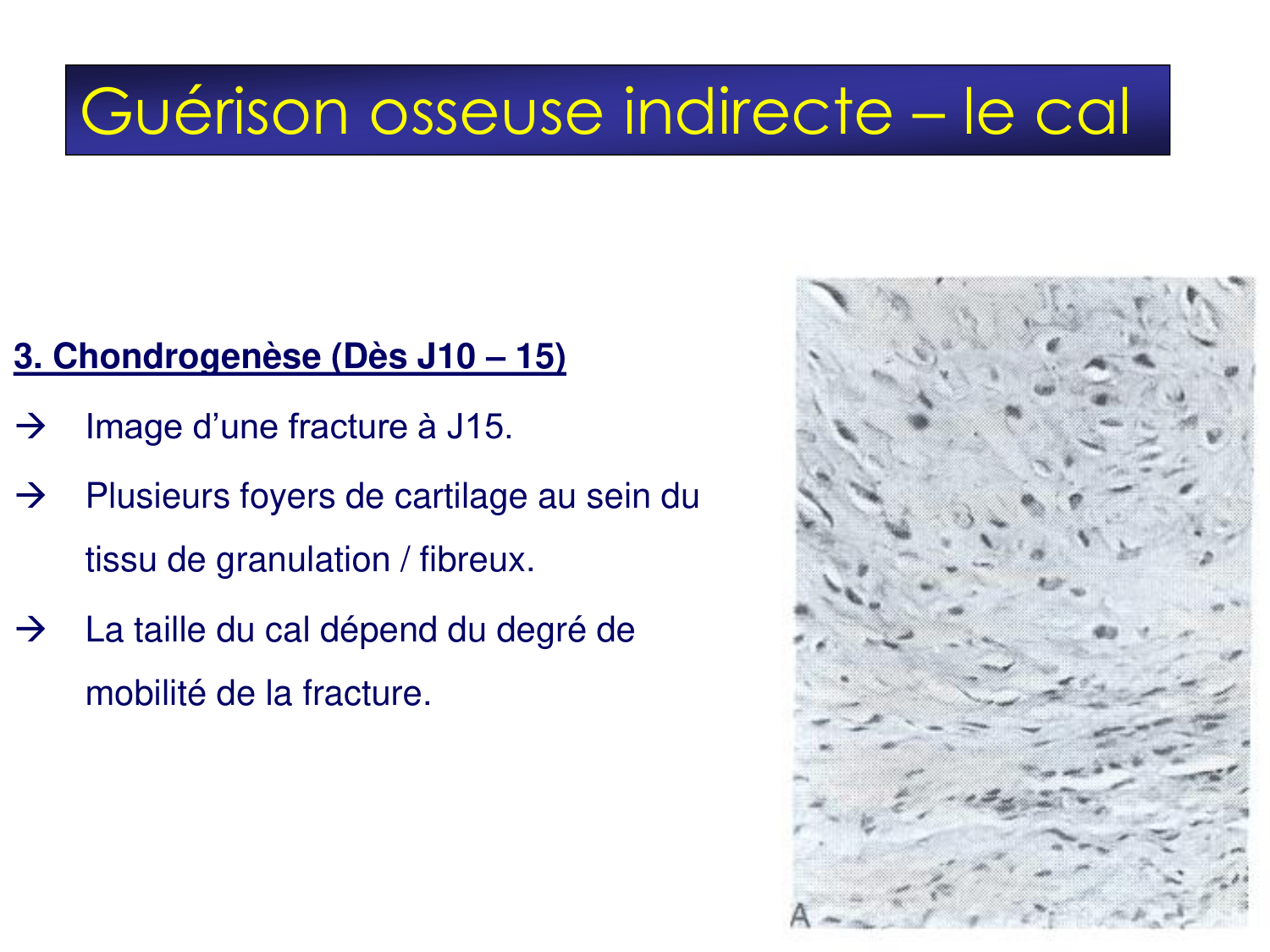Fractures et réparation page 11