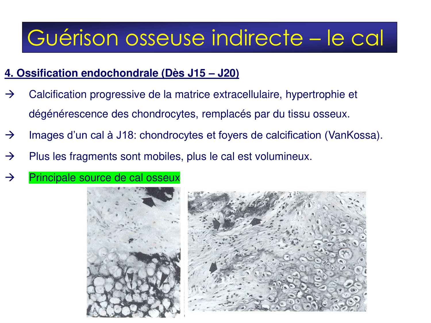 Fractures et réparation page 12