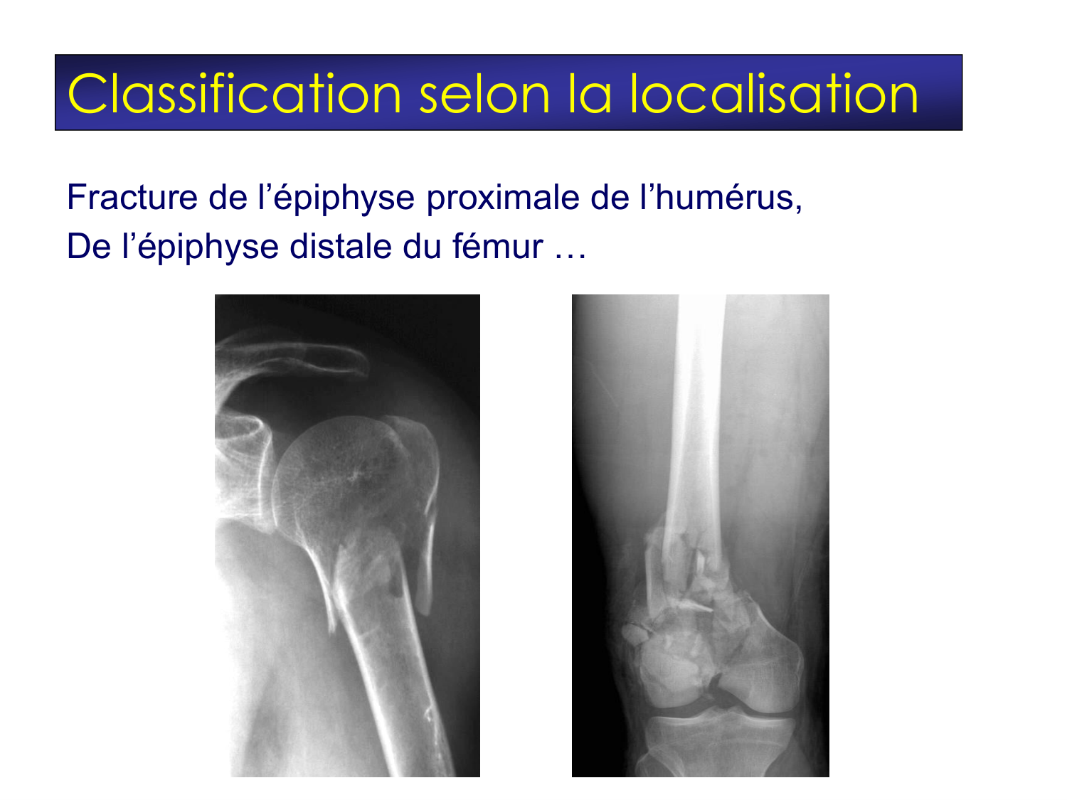 Fractures et réparation page 19