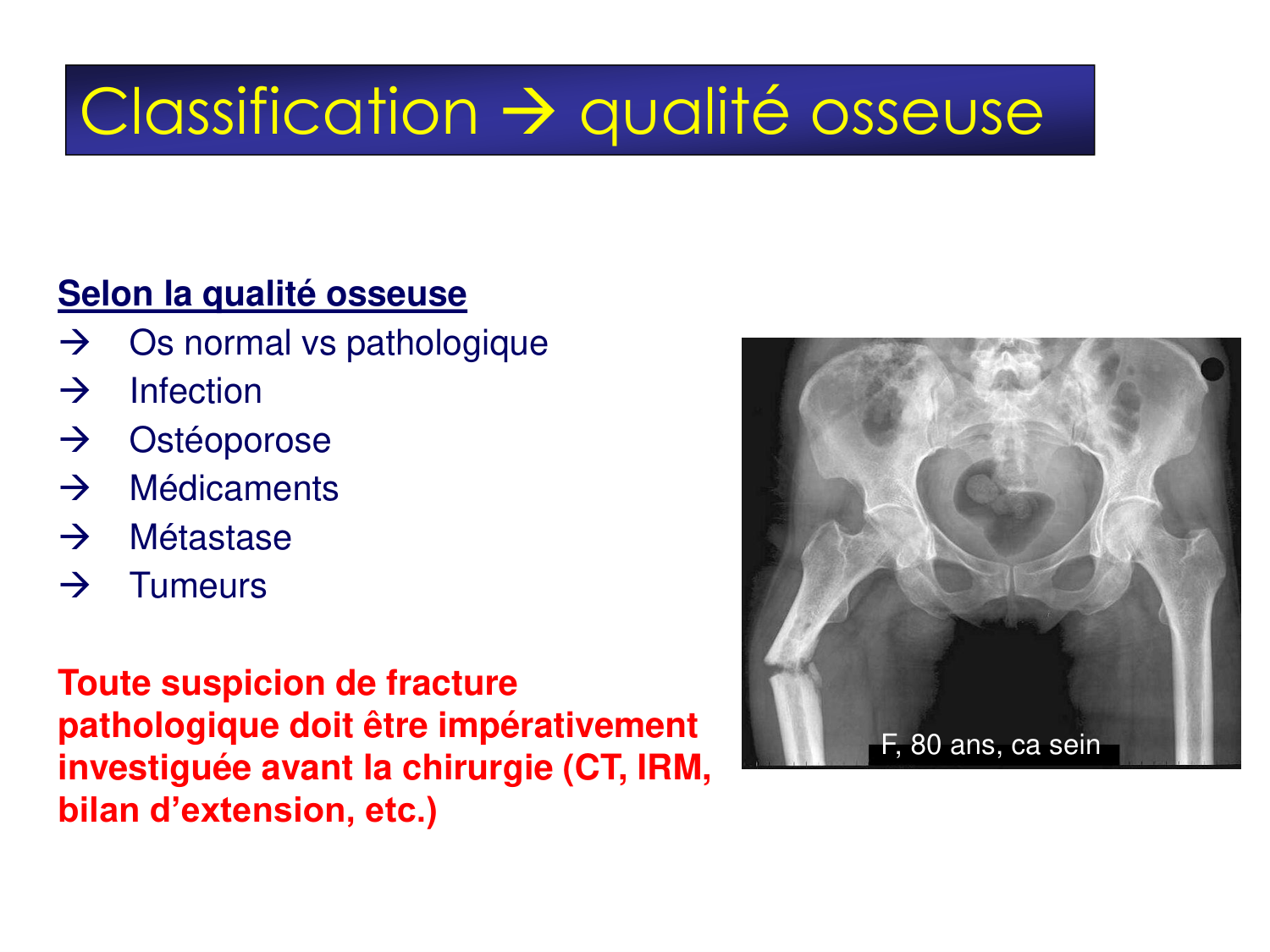 Fractures et réparation page 28