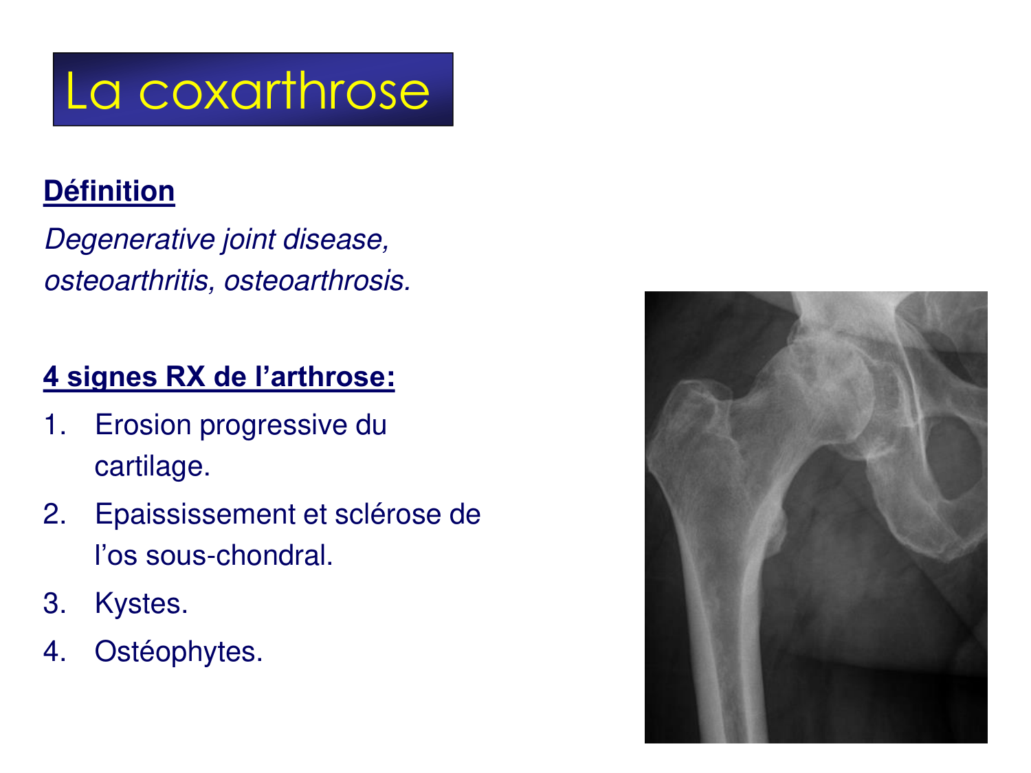 Fractures et réparation page 56