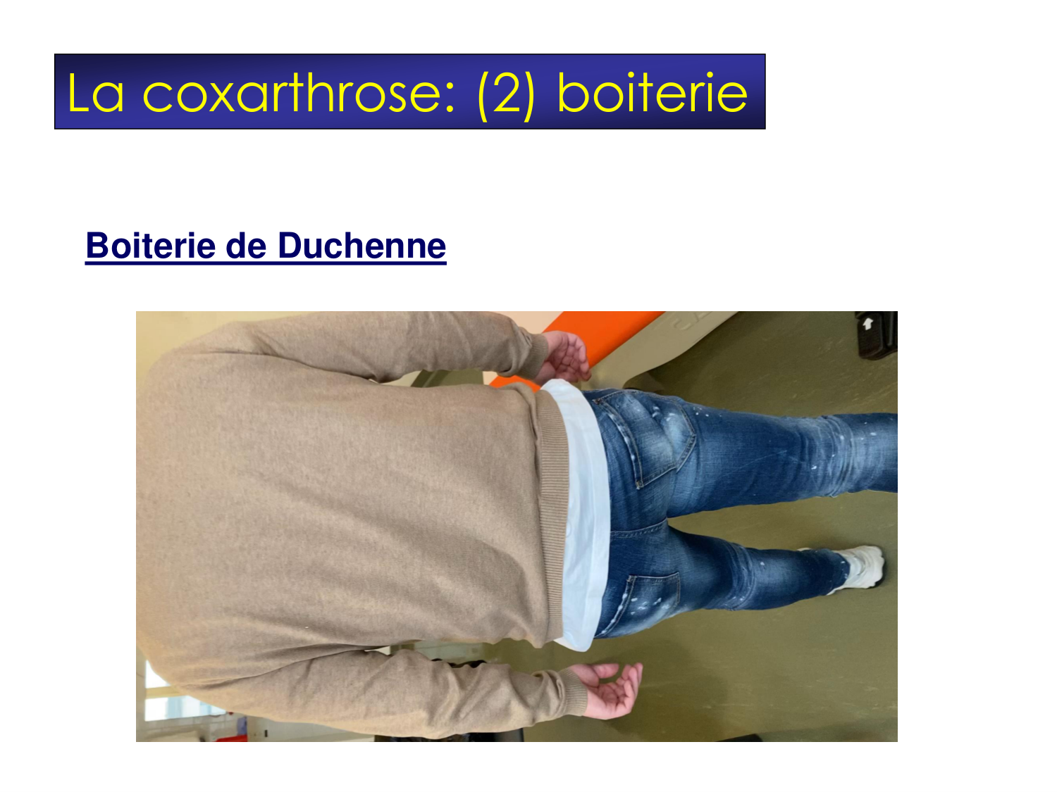 Fractures et réparation page 61