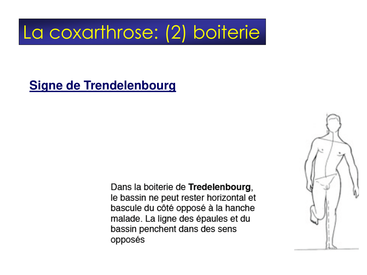 Fractures et réparation page 62