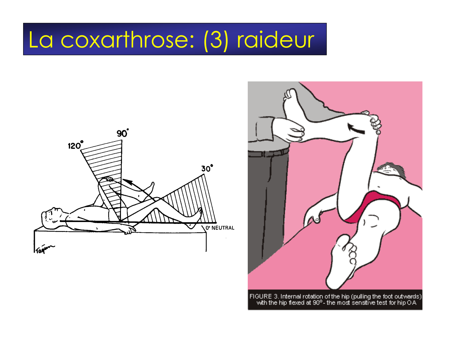 Fractures et réparation page 63