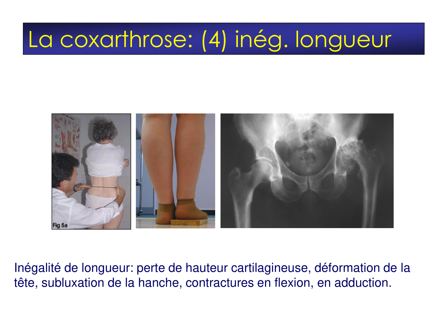 Fractures et réparation page 64