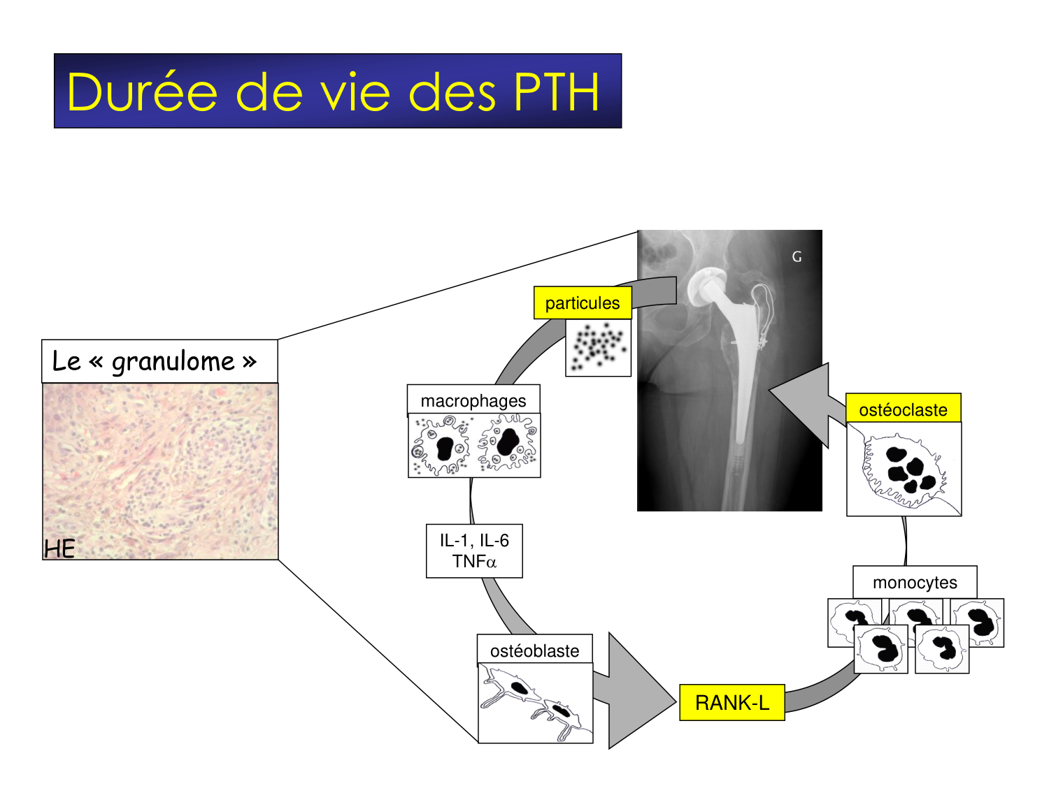Fractures et réparation page 68