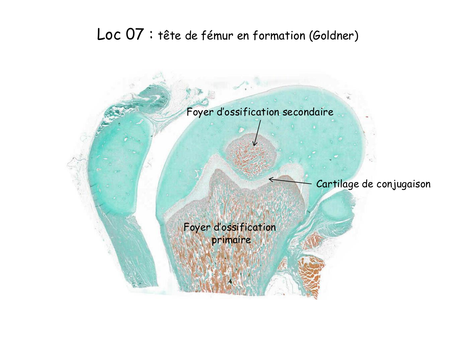 TP os et cartilage page 8
