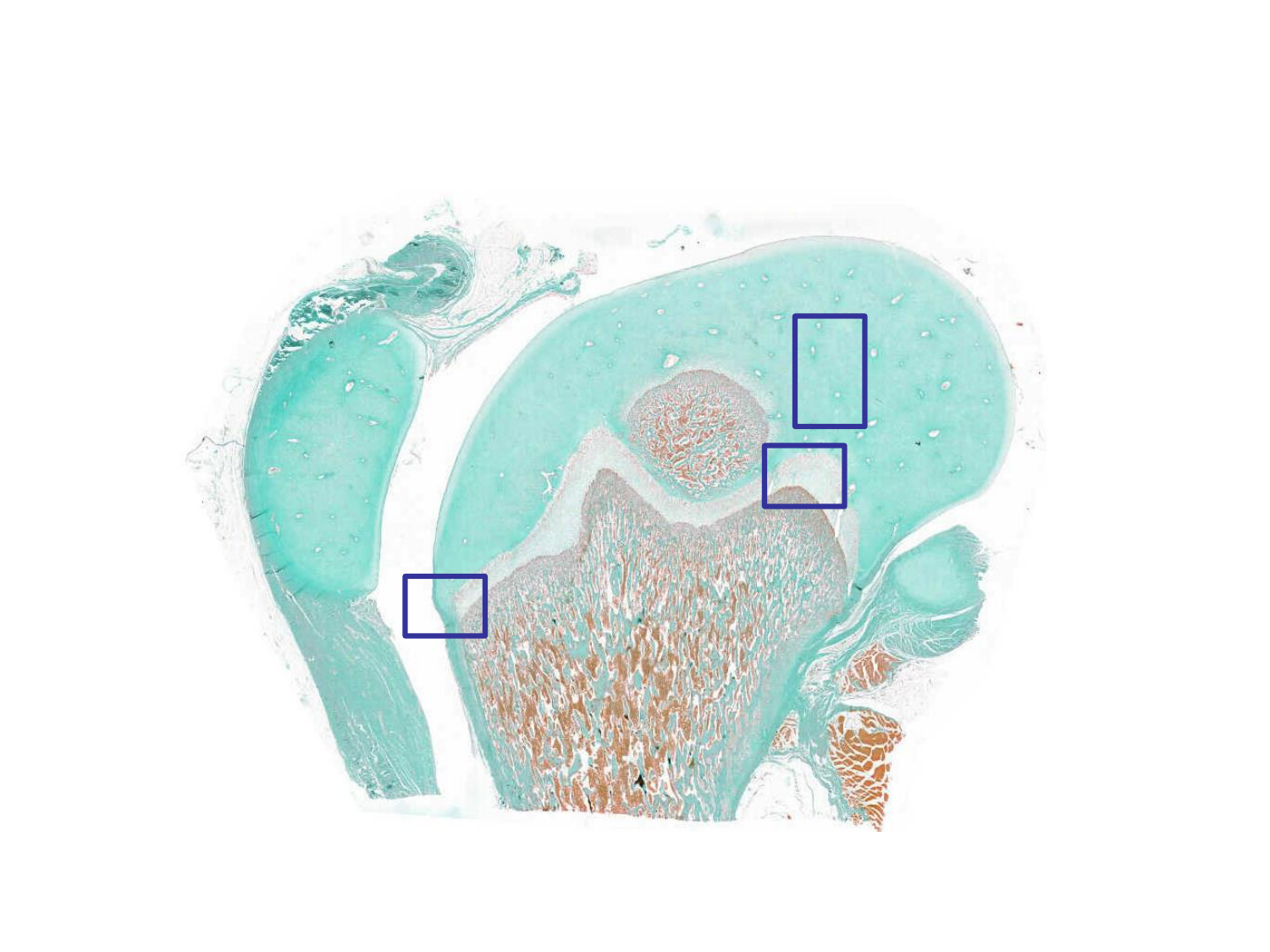 TP os et cartilage page 9